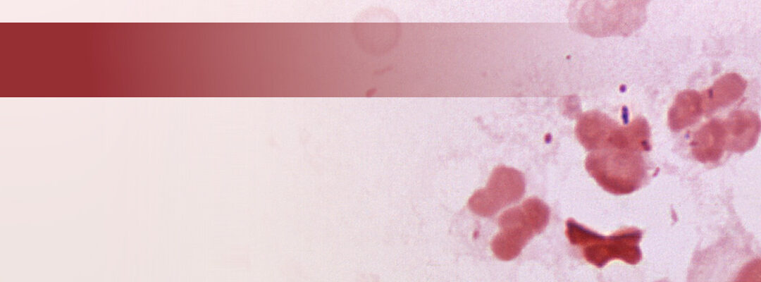 Neues zur Antibiose und Impfung