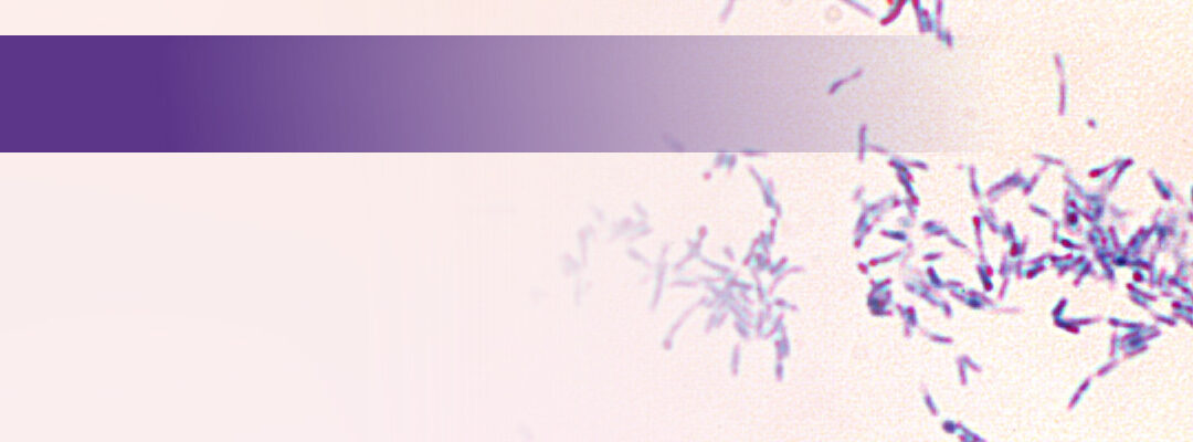 Diphtherie: Größter Ausbruch seit 70 Jahren