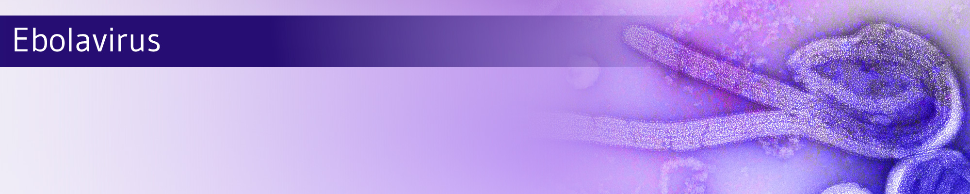 Ebolavirus-Partikel unter dem Mikroskop, länglich und fadenförmig.