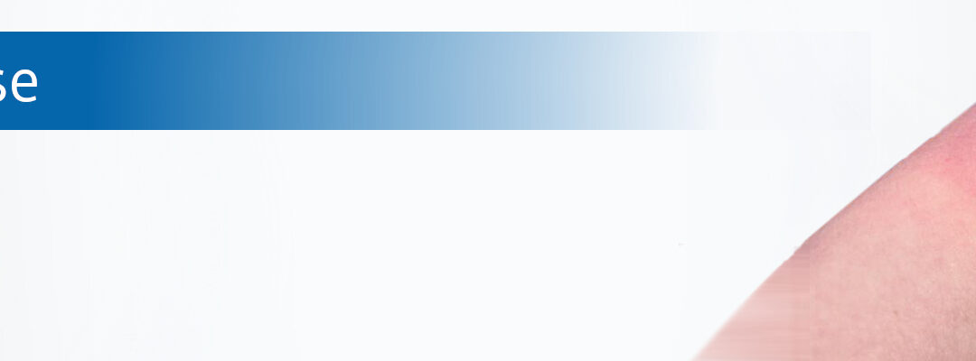 Borreliose: Zahl der Infektionen steigt weiter