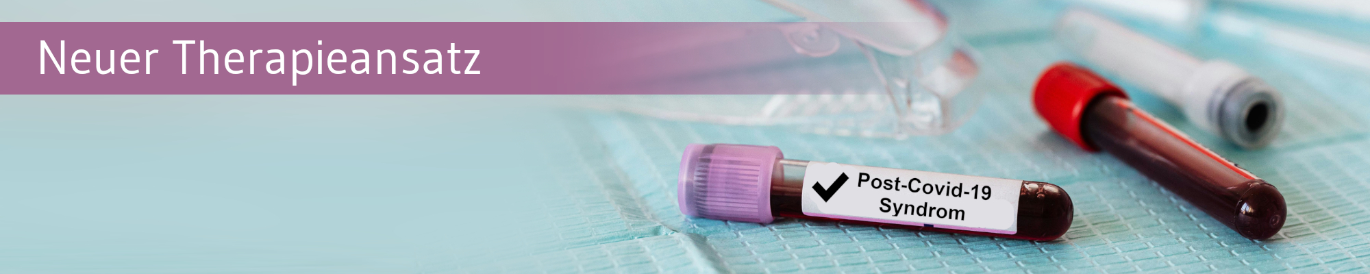 Neue Ansatzpunkte für Post-Covid-Therapie
